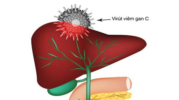 Bác sĩ hướng dẩn thực phẩm người viêm gan C nên dùng 