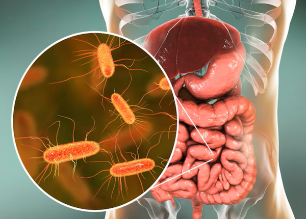 Loạn khuẩn đường ruột là gì? Tại sao chúng ta lại hay mắc phải?