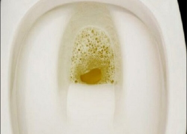 Đi ngoài phân lỏng có bọt: Đặc điểm, nguyên nhân và hướng xử lý